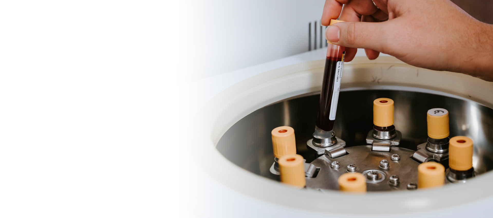 pathology-blood-testing-mudgee-medical-centre pathology blood testing mudgee medical centre